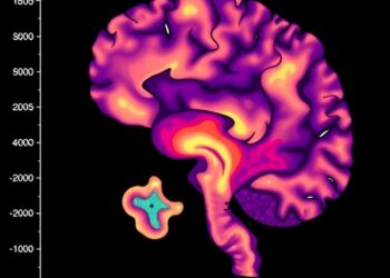 Denoised MDS-UPDRS Reveals New Parkinson’s Progression Patterns — Medicine