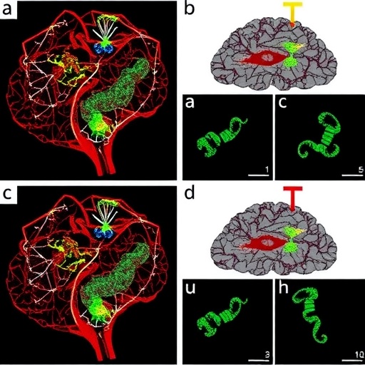 Dietary Changes Remodel Chromatin Structure and Prolong Survival in Glioma Models — Cancer