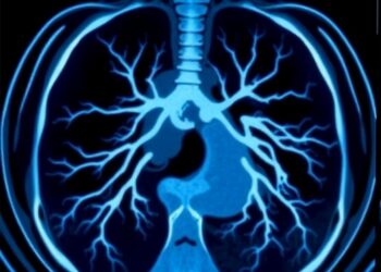 Endoscopic Swallowing Patterns Linked to Pneumonia in Elderly — Medicine