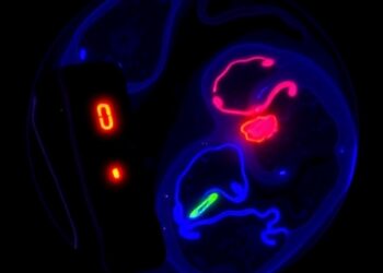 Fluoxetine Alters Endothelial Cholesterol via SREBP2 Activation — Psychology & Psychiatry