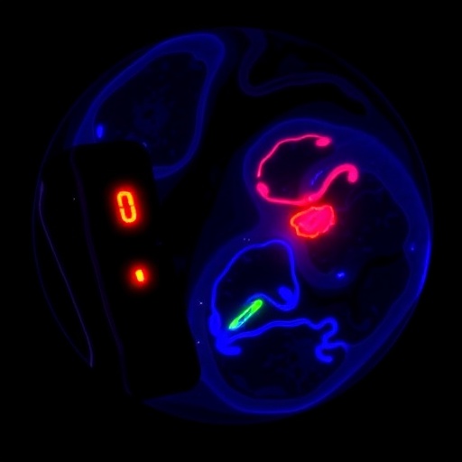 Fluoxetine Alters Endothelial Cholesterol via SREBP2 Activation — Psychology & Psychiatry