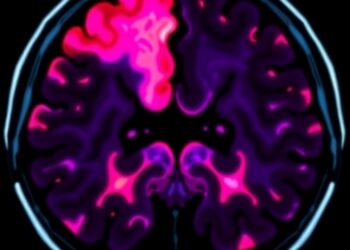 Furmonertinib and Bevacizumab Tackle Resistant Leptomeningeal Metastasis — Cancer
