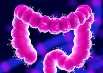 Fusobacterium periodonticum Spurs Colorectal Cancer via Decanoic Acid — Medicine