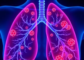 GPR84 Drives Lung Inflammation via ZBP1-PANoptosome Activation — Medicine