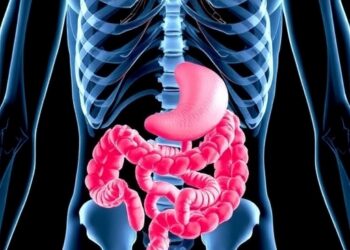 Gut Microbiome Associated with Increased Osteoporosis Risk in Primary Hyperparathyroidism — Medicine