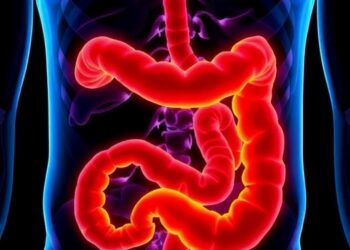 Increase in Colorectal Cancer Among Young Adults in Germany Observed—Still Lower Than US Rates — Cancer