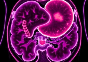 Infigratinib Shows Promise for FGFR2-Positive Gastric Cancer — Cancer