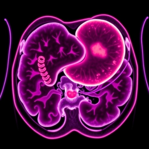 Infigratinib Shows Promise for FGFR2-Positive Gastric Cancer — Cancer