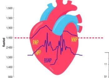 LAD/BSA, NT-proBNP Predict Pediatric Heart Death — Technology and Engineering