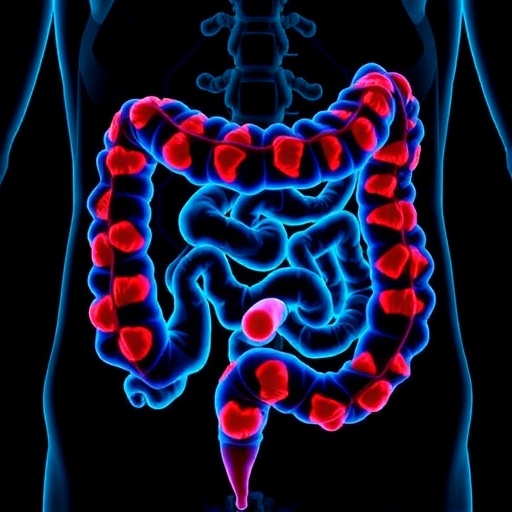 Leukocyte Levels Linked to Colorectal Cancer Survival — Cancer