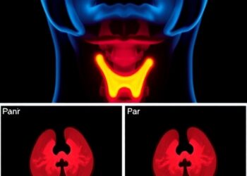 Light-Based Imaging Advances Promise Enhanced Thyroid Cancer Diagnosis and Fewer Surgeries — Cancer