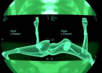 Marshall Health Network and Intermed Labs Pioneer Next-Generation Surgical Visualization with Spatial Arthroscopy — Medicine