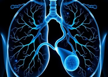 Multimodal Multitask AI Transforms Lung Cancer Grading — Medicine
