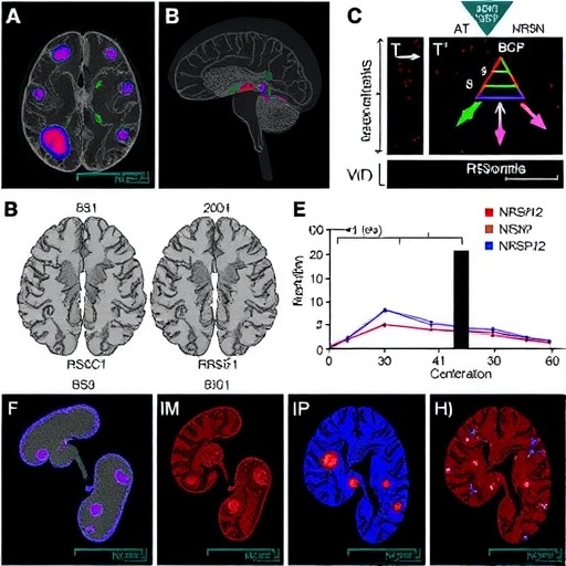 NRSN2 Deficiency Disrupts Memory via NMDA Impairment — Psychology & Psychiatry