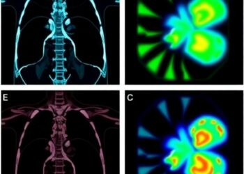 New Integrated PET Imaging Platform Quickly Identifies Clear Surgical Margins in Osteosarcoma Resection — Medicine