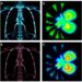 New Integrated PET Imaging Platform Quickly Identifies Clear Surgical Margins in Osteosarcoma Resection — Medicine