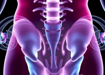 New Standards Reshape Platinum-Resistant Ovarian Cancer Treatment — Cancer