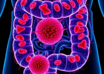 New Study Reveals Mechanisms Behind High Iron Levels in Colorectal Cancer Cells — Cancer