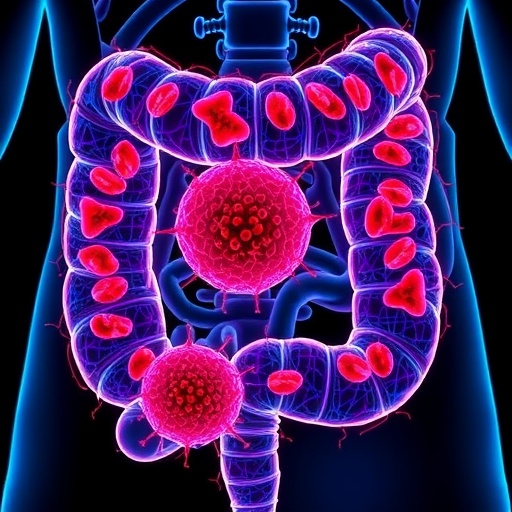 New Study Reveals Mechanisms Behind High Iron Levels in Colorectal Cancer Cells — Cancer