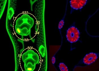 New Therapeutic Approach for Inflammatory Arthritis: Targeting Pim1 to Modulate Mitochondrial Metabolism and Th17 Cell Differentiation — Medicine