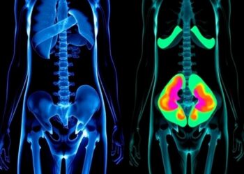 PET Imaging Reveals Whole-Body Metabolic Shifts Following Bariatric Surgery — Medicine