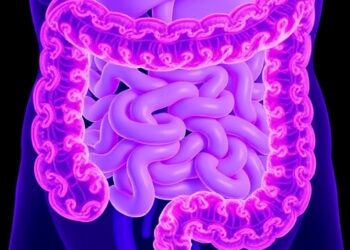 Paneth Cell Metaplasia: A Potential Protective Mechanism in Ulcerative Colitis — Cancer