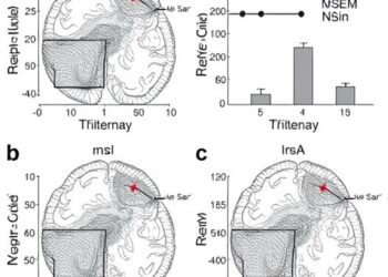 Patients with Isolated REM Behavior Disorder Show α-Synuclein Negativity — Medicine