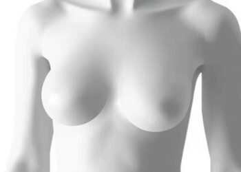 Planetary Health Diet Index Linked to Breast Cancer Risk — Cancer