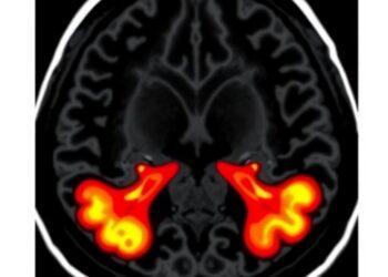 Prostate MRI Enhances Biopsy Accuracy and Outcomes — Medicine