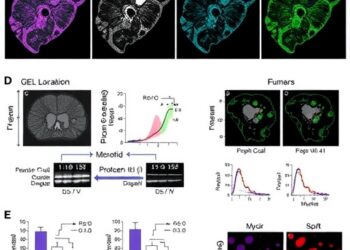 Protein in Tumor Microenvironment Drives Colorectal Cancer Progression and Immune Evasion — Cancer