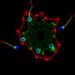 RAF265 Targets USP10/SCD1 to Trigger Ferroptosis — Medicine