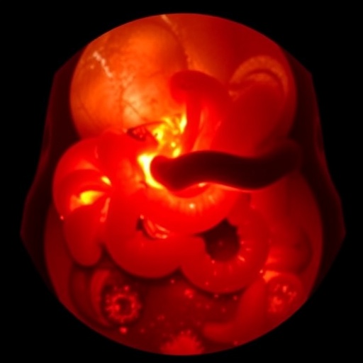 Rare Intestinal Tumor Mimicking Intussusception Sheds Light on Diagnostic Challenges in Young Women — Cancer