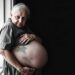 Sarcopenia, Obesity, and Frailty: Impact on Mortality — Medicine