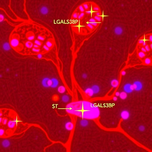 Secretory LGALS3BP Drives Sepsis Liver Damage via Pyroptosis — Medicine