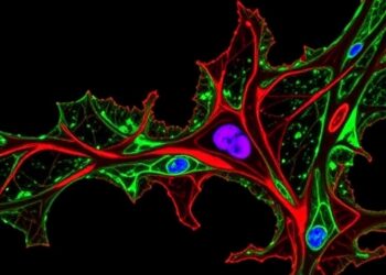 Tumor WNT7A Drives Lung Fibroblast Changes, Boosts Metastasis — Cancer