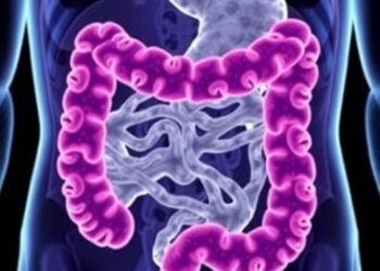 Tumour Deposits Drive Immune Evasion, Worsen Colorectal Prognosis — Cancer