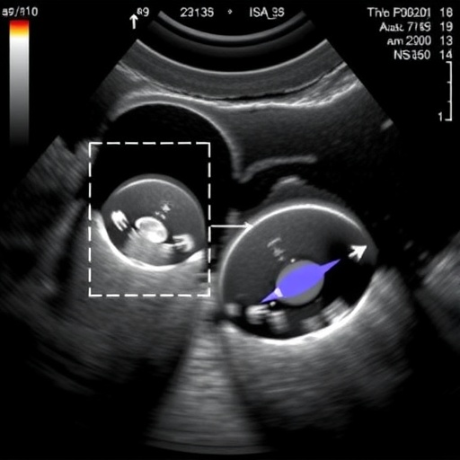 Ultrasound Elastography Advances Fetal Rabbit Lung Assessment — Technology and Engineering