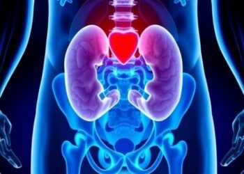 Urolithiasis in Cancer Patients: Causes and Insights — Medicine