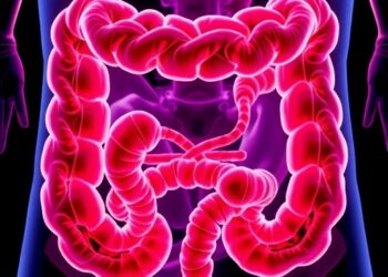 Breakthrough Marker Identified as the Achilles’ Heel of Highly Aggressive Metastatic Colorectal Cancer — Biology
