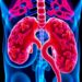 Decoding the Pathology of Prostate Cancer: New Insights Uncovered — Cancer