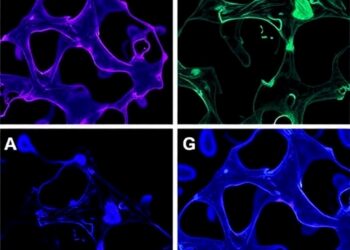 Hepatic IFRD1 Alleviates Metabolic Dysfunction-Linked Steatohepatitis Through the GLUD1/α-KG Pathway — Biology