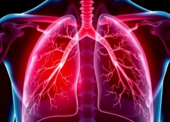New Expert Guidelines Enhance Detection and Management of Lung Disease in Rheumatoid Arthritis Patients — Medicine