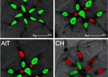 ACSS2-KAT5 drives histone crotonylation to trigger MASLD-to-MASH inflammation