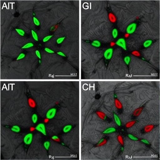 ACSS2-KAT5 drives histone crotonylation to trigger MASLD-to-MASH inflammation