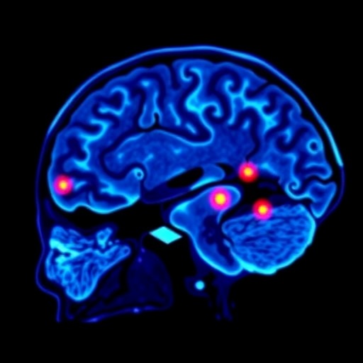 Amyloid PET Quantification Enhances Alzheimer’s Disease Diagnosis Accuracy