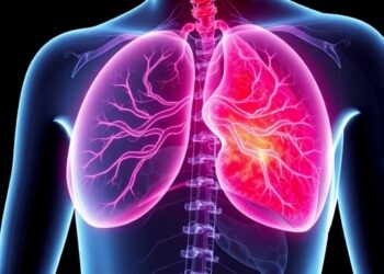 Bile Acid Accumulation Promotes Breast Cancer Spread, Study Finds