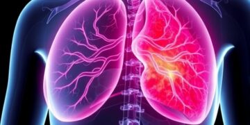 Bile Acid Accumulation Promotes Breast Cancer Spread, Study Finds