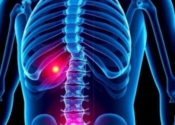 Blocking Siglec-binding Sialoglycans to Halt Prostate Cancer Bone Spread