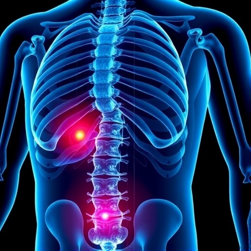Blocking Siglec-binding Sialoglycans to Halt Prostate Cancer Bone Spread