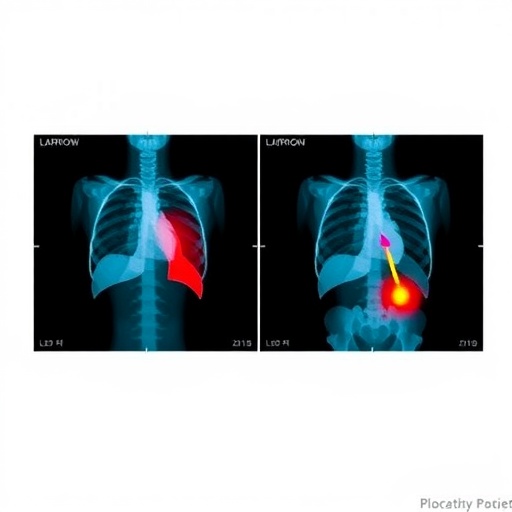 Blood Test Model Predicts Postoperative Lung Infections in Older Hip Fracture Patients